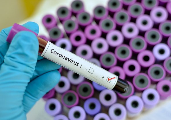 PHB Coronavirus (Test)